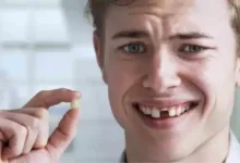 حلم سقوط الأسنان